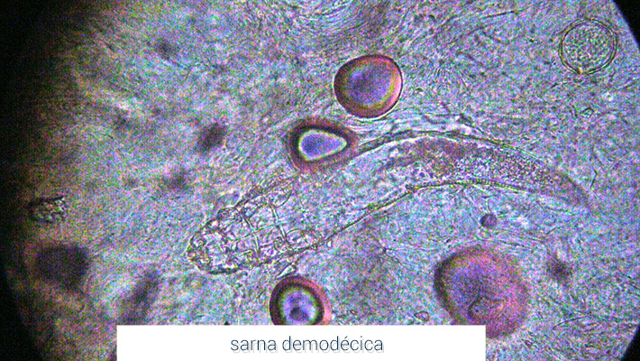 caso_dermatologia_sarna_demodecica