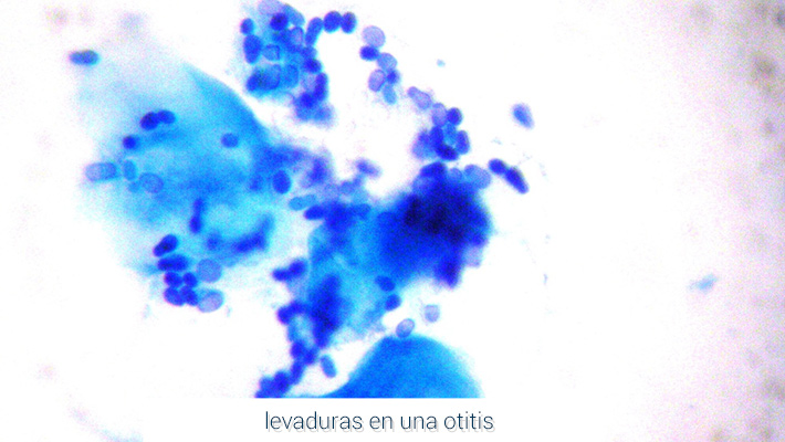 levaduras_en_una_otitis